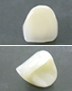 e-max